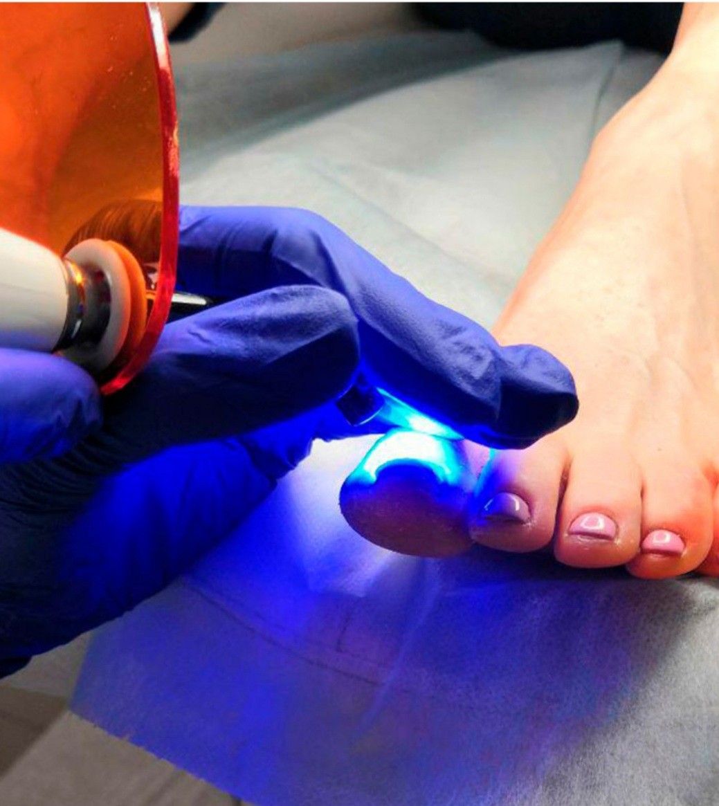 Pedicure Clínico en Barranquilla - PODOLOGA MARY Belén